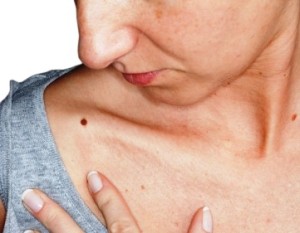 checking-your-skin-for-melanoma_jul_12