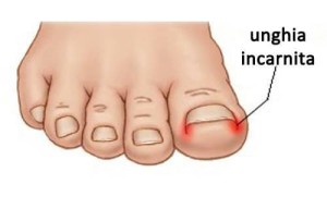 unghieincarnite