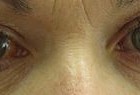 SALUTE MUGELLO: Il glaucoma…come individuarlo, come sconfiggerlo