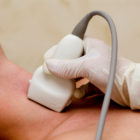 Prorogate sino al 27 marzo le visite a prezzo scontato per prevenire ictus e malattie cardiovascolari
