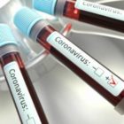 Tamponi rapidi presso la Fondazione tutti i venerdì di luglio